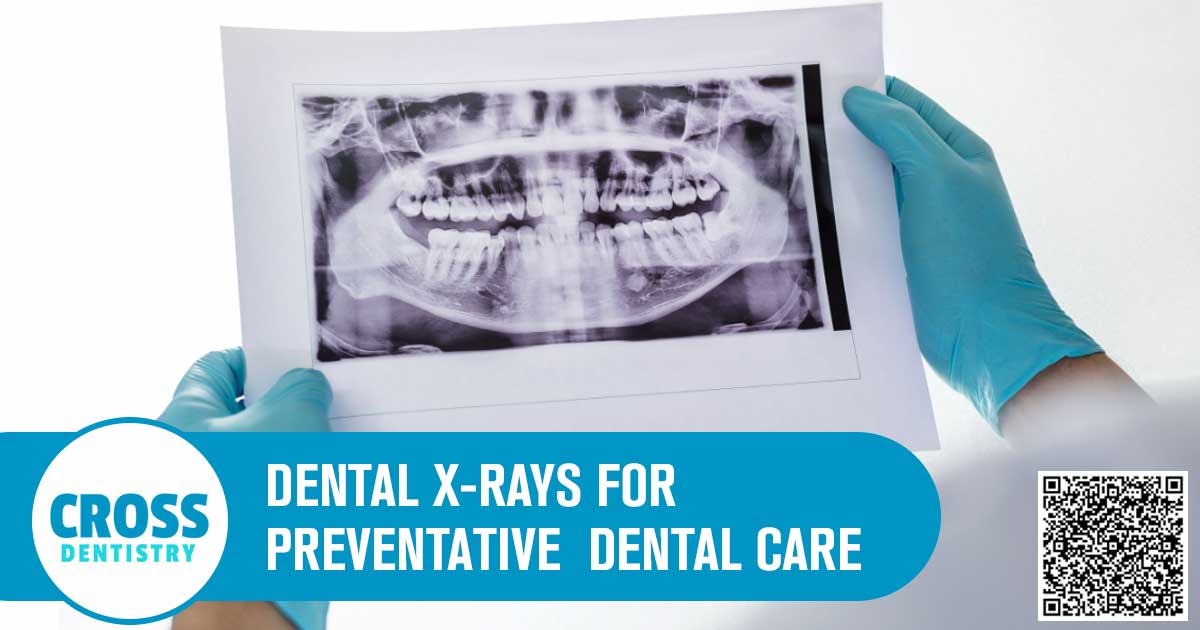 Dental X-Rays for Preventative Dental Care