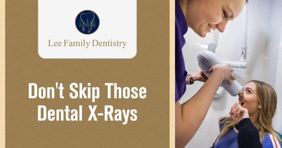 What are Dental XRays and Why are they Important? Lee Family Dentistry