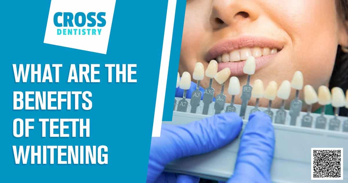 What Are the Benefits of Teeth Whitening?