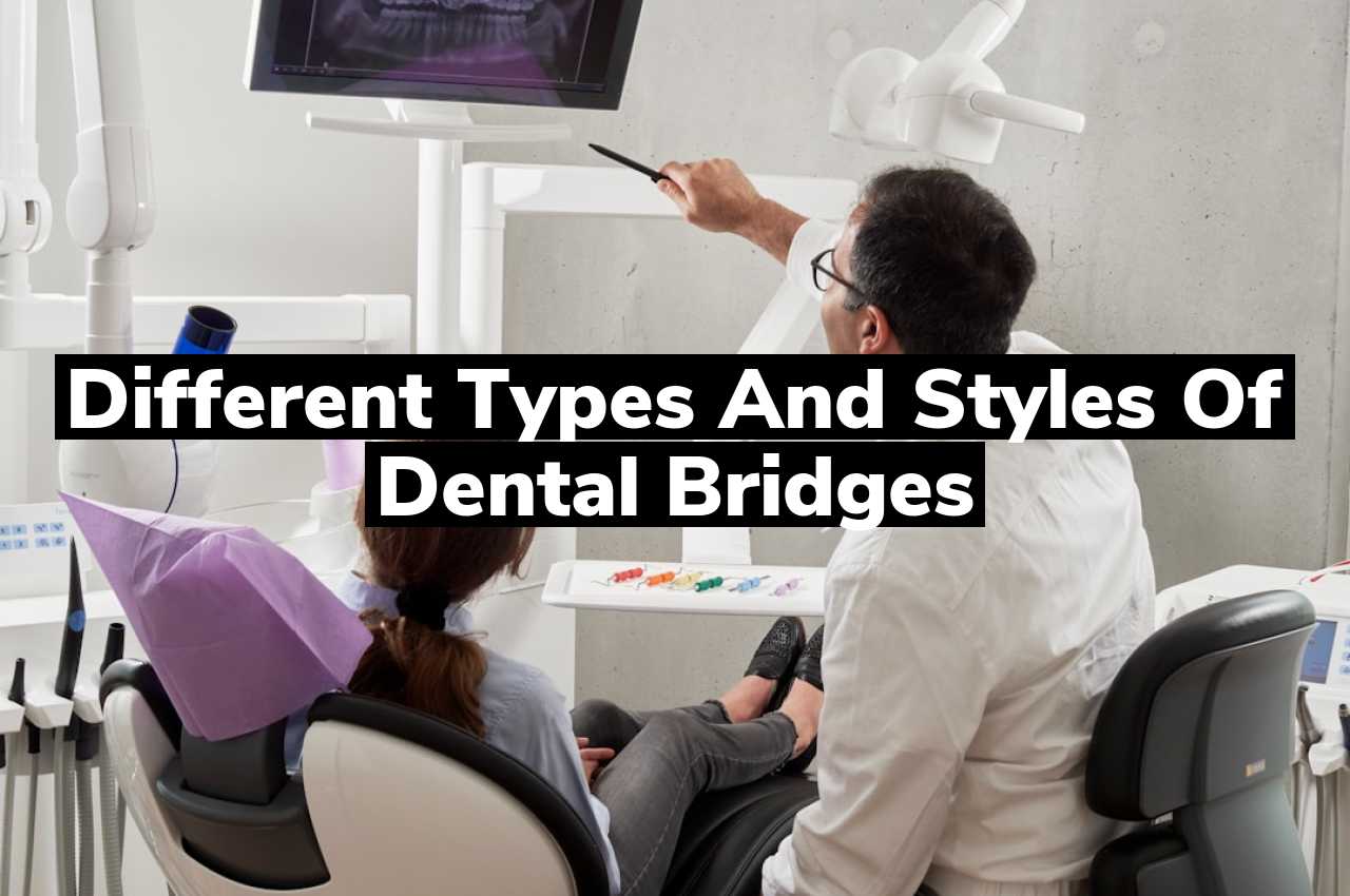 Different Types and Styles of Dental Bridges