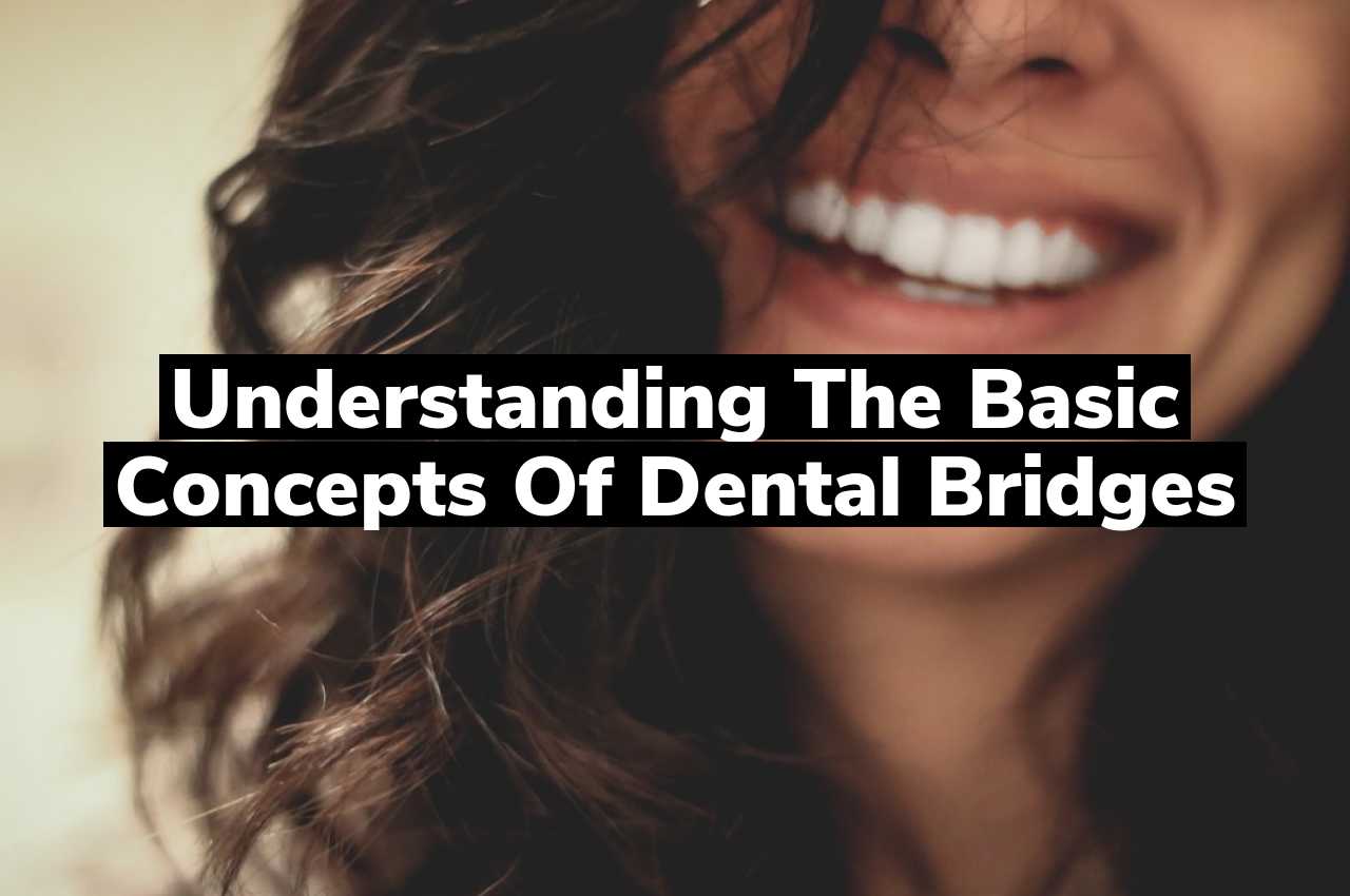 Understanding the Basic Concepts of Dental Bridges