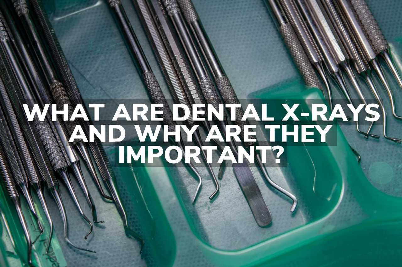 What are Dental X-Rays and Why are they Important?