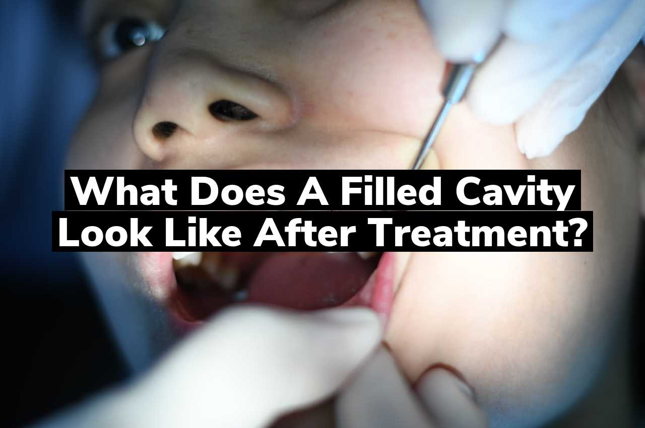 What does a filled cavity look like after treatment?